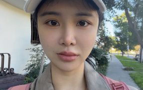 我是不是得了荨麻疹，嘴巴莫名其妙肿起来了，看着好好笑😅😅