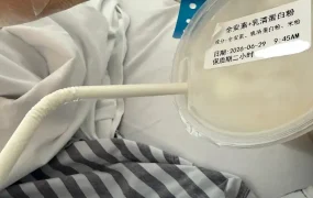 前几天刚入院的时候全身都肿得有点发黄，这几天都慢慢在消了，胜利在望！